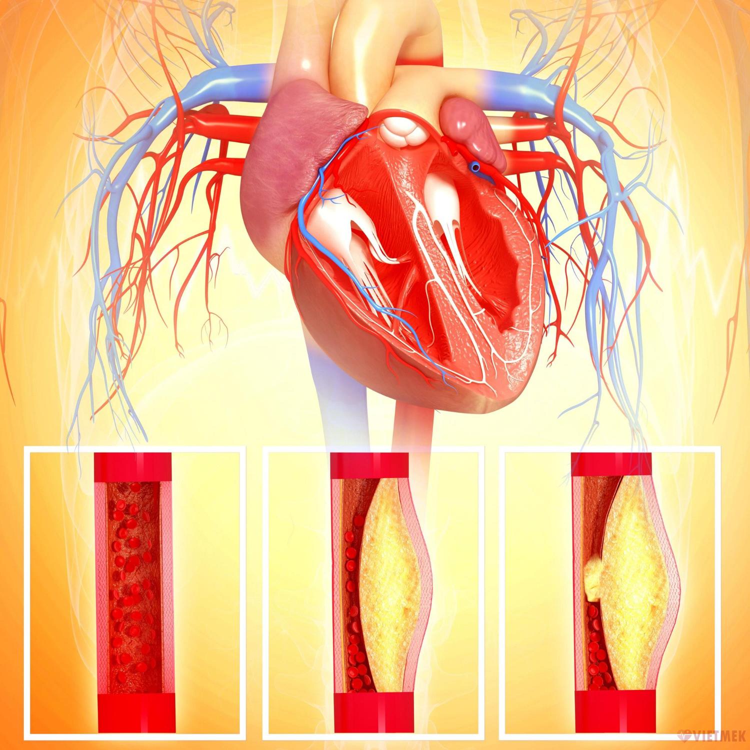 Ngăn ngừa vôi hóa mạch máu, giảm nguy cơ mắc các bệnh tim mạch.