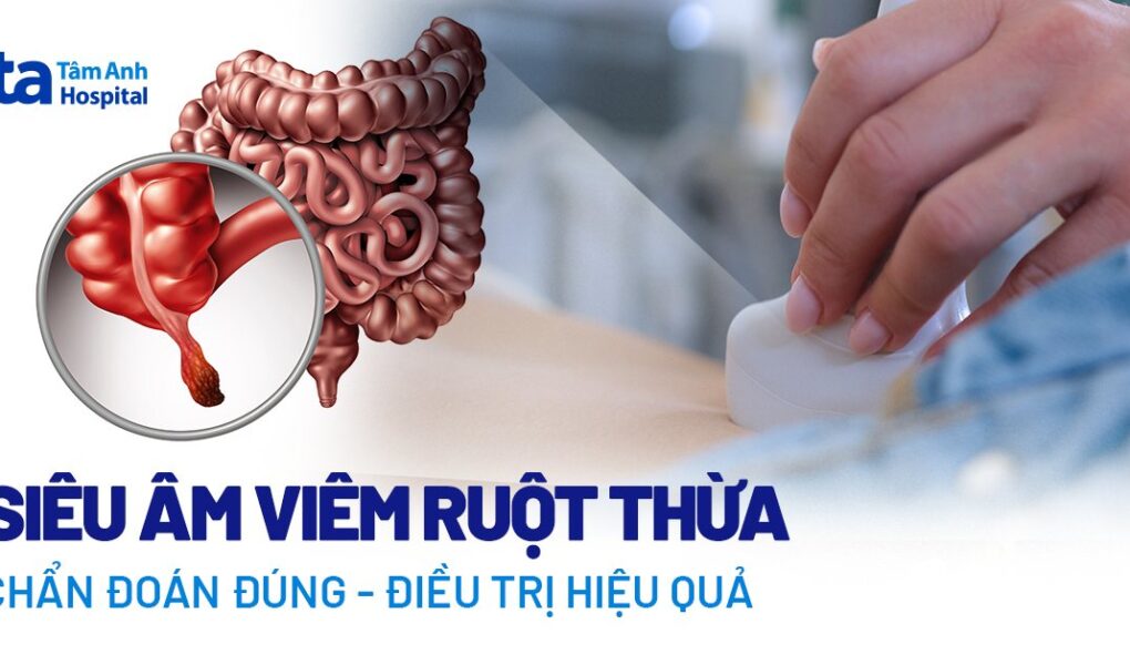 1716466795 Doc vi thong tin Sieu am viem ruot thua Khi