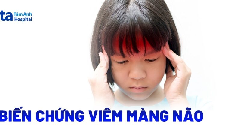 Doc vi thong tin 3 bien chung viem mang nao