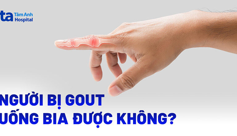 Doc vi thong tin Bi gout uong bia duoc khong