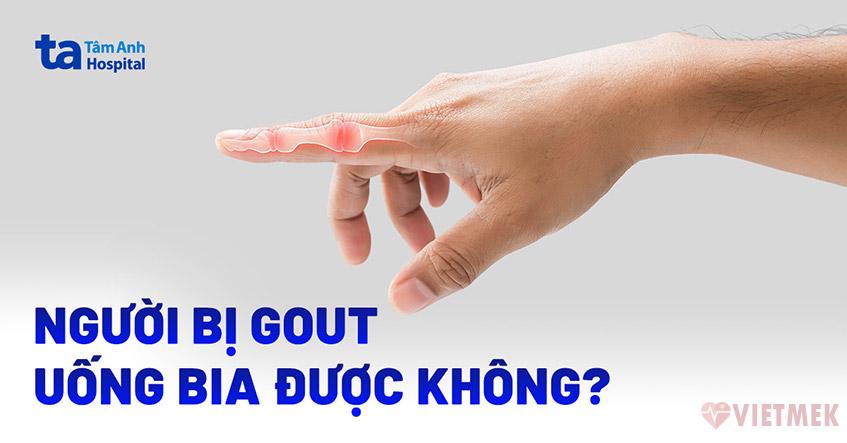 Doc vi thong tin Bi gout uong bia duoc khong