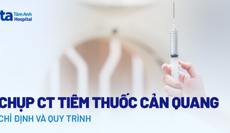 Doc vi thong tin Chup CT tiem thuoc can quang