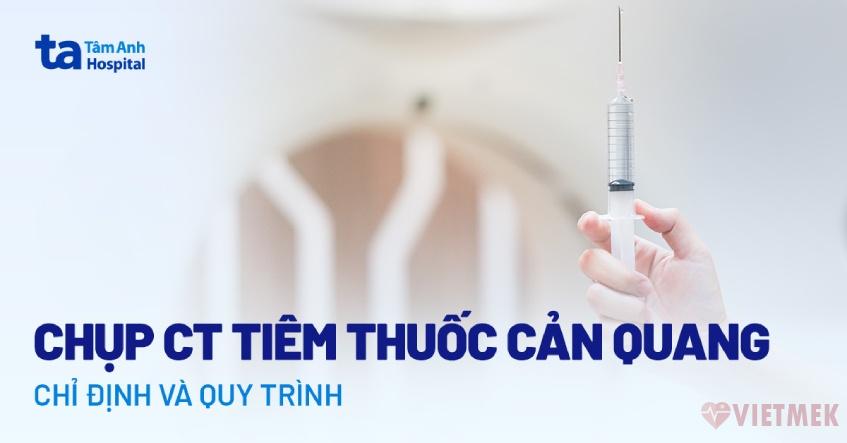 Doc vi thong tin Chup CT tiem thuoc can quang