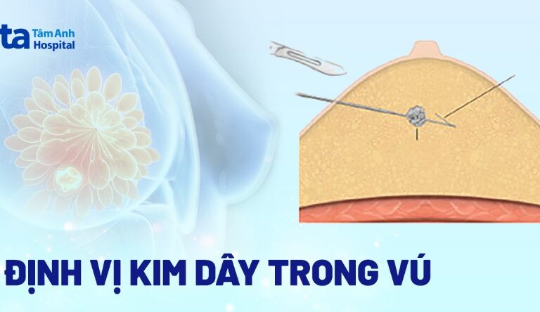 Doc vi thong tin Dinh vi kim day trong vu