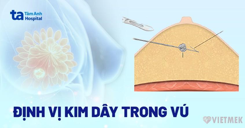 Doc vi thong tin Dinh vi kim day trong vu