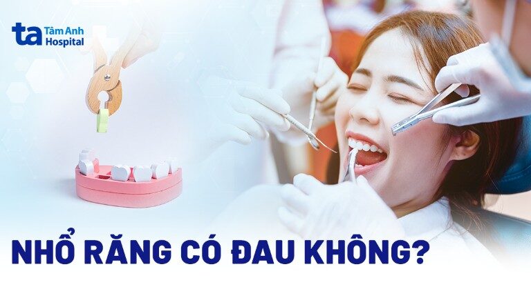 Doc vi thong tin Nho rang co dau khong Nhung