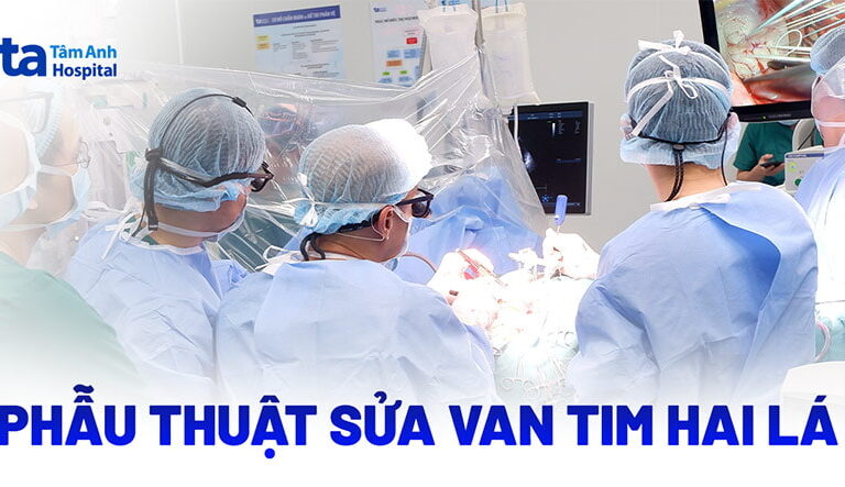 Doc vi thong tin Phau thuat sua van tim hai