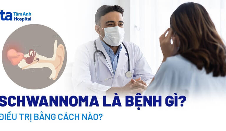 Doc vi thong tin Schwannoma la gi Trieu chung nguyen