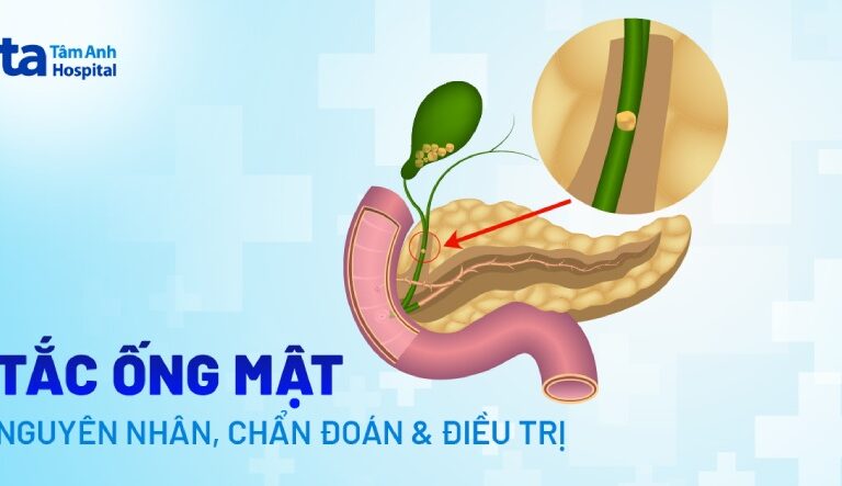 Doc vi thong tin Tac ong mat Nguyen nhan dau