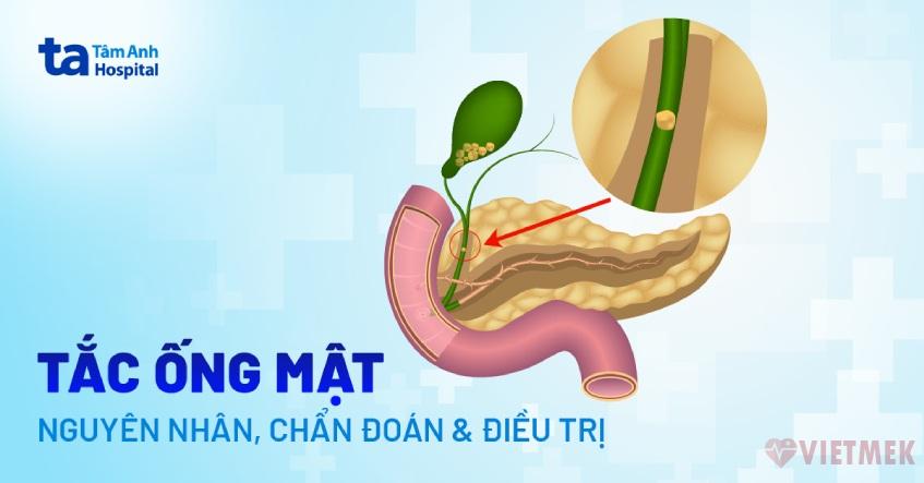 Doc vi thong tin Tac ong mat Nguyen nhan dau