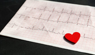 Huyết áp là lực mà máu tác động lên thành mạch máu. Nguồn gốc của lực này là sự co bóp của tim, buộc máu ra khỏi tim và vào mạch máu.