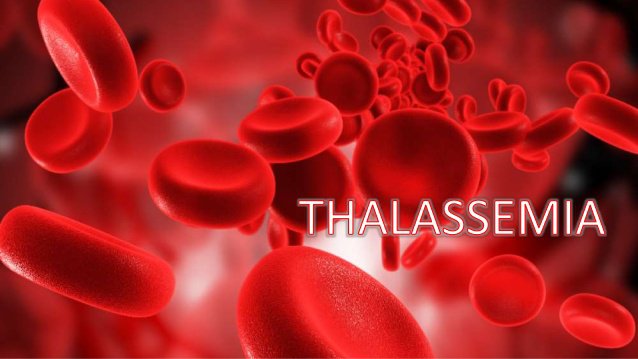 20200411 132357 676766 thalassemia 1 638.max