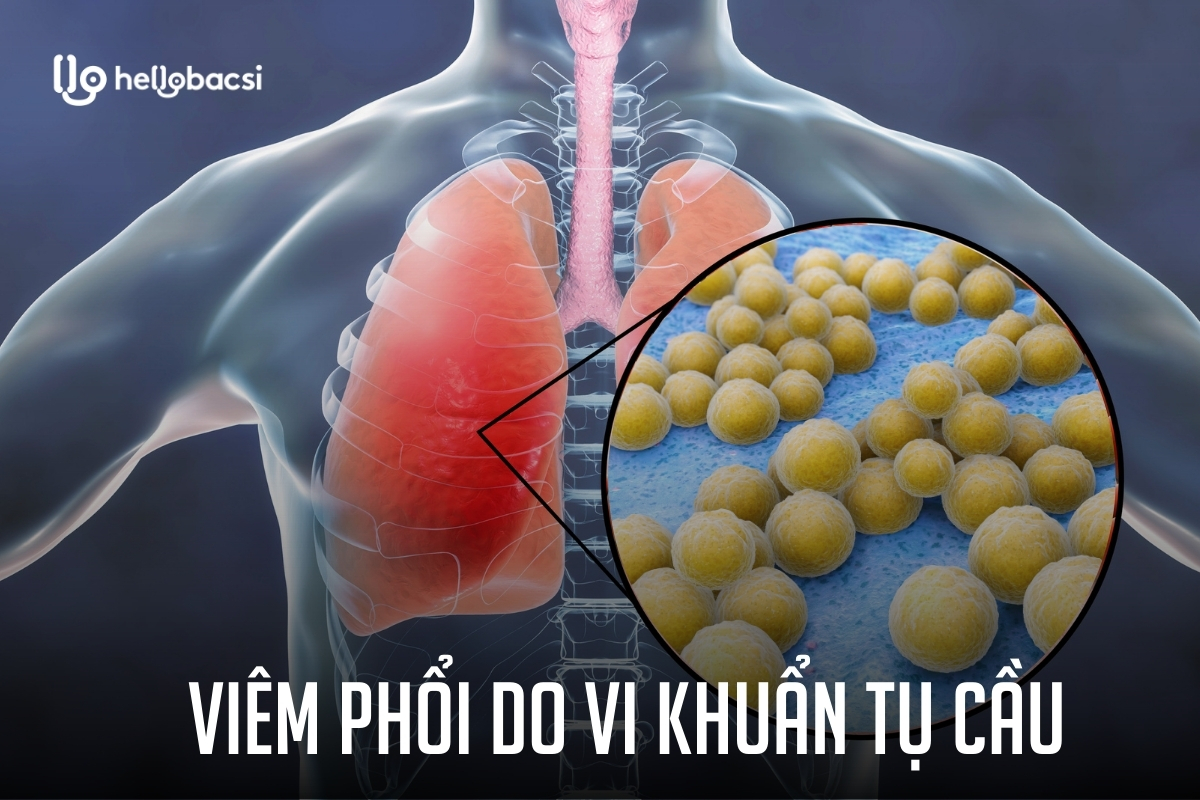 Vi khuẩn tụ cầu