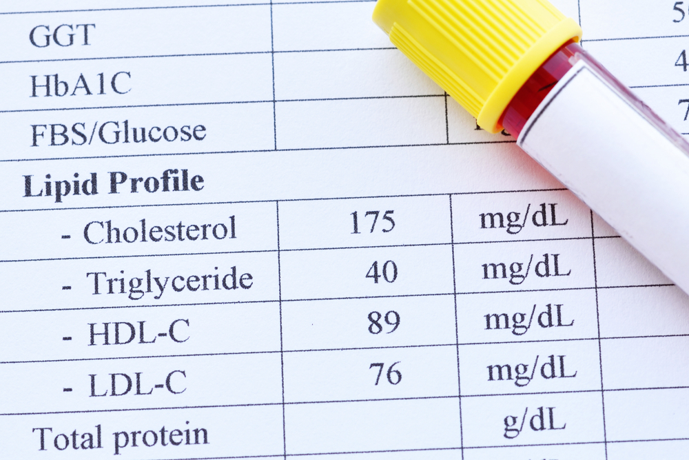 1723424515 960 Chi so cholesterol toan phan bao nhieu la an toan