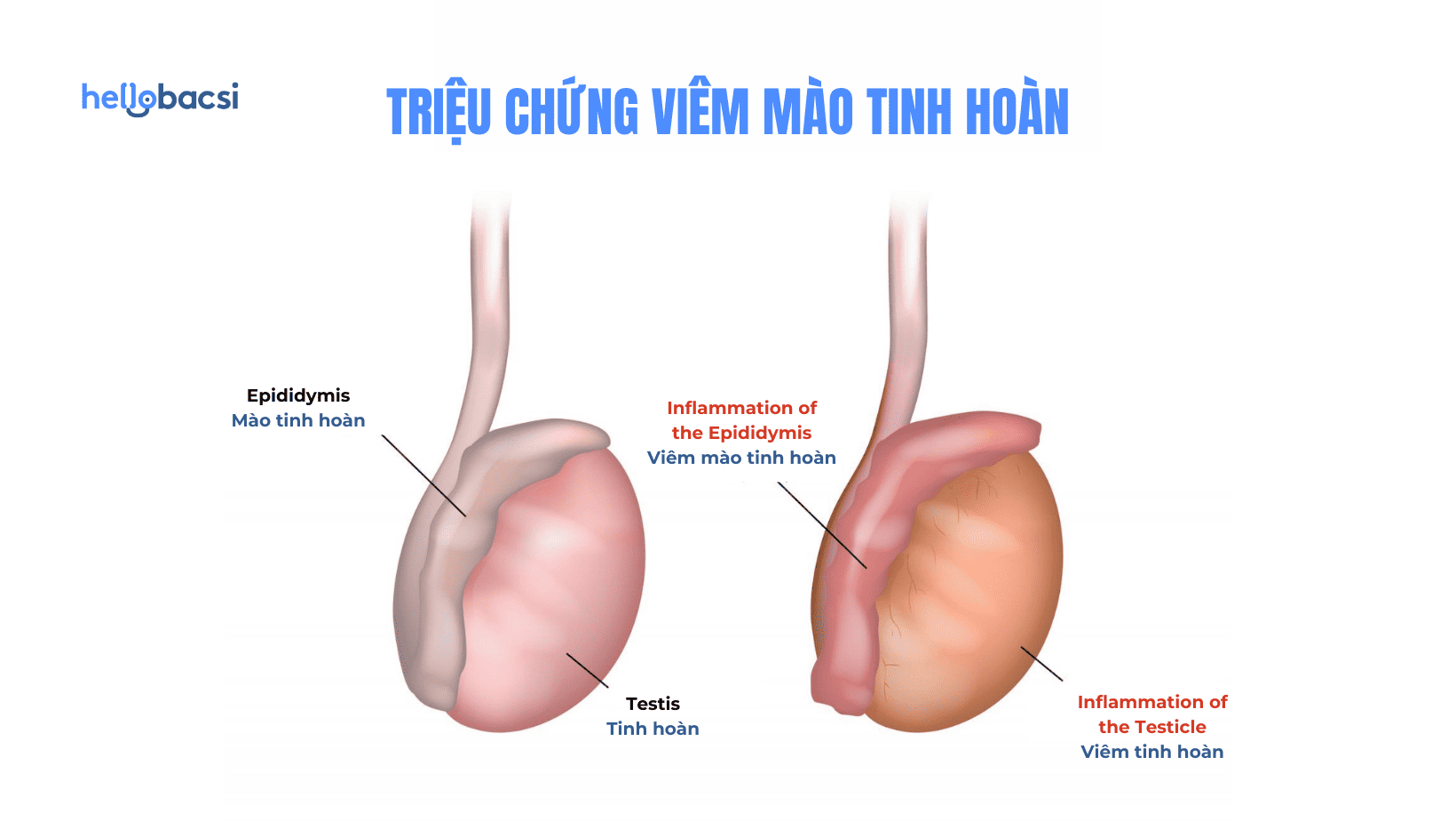 Thời gian điều trị