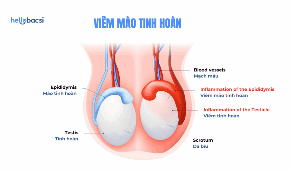 1723583904 Giai phap nao giup viem mao tinh hoan mau khoi