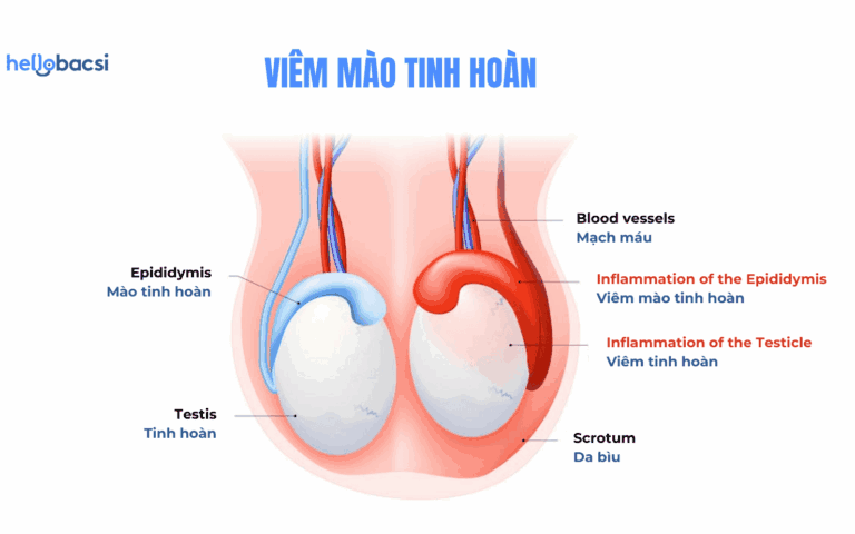 1723583904 Giai phap nao giup viem mao tinh hoan mau khoi