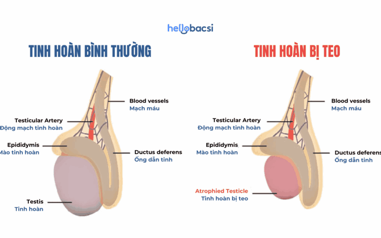 1723606749 Giai phap nao giup nam gioi phuc hoi tinh hoan