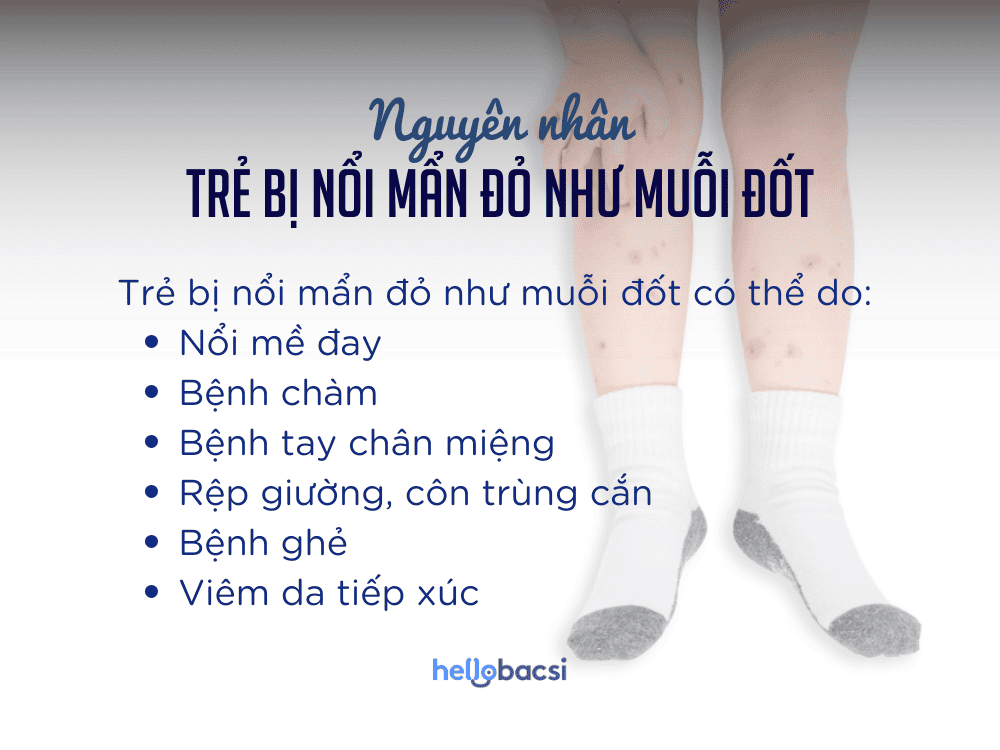 6 Nguyên nhân khiến trẻ bị nổi mẩn đỏ như muỗi đốt